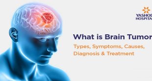 Understanding Brain Tumors: Diagnosis, Treatment, and Prognosis