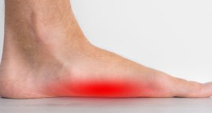 Flat feet - When should I seek medical help?