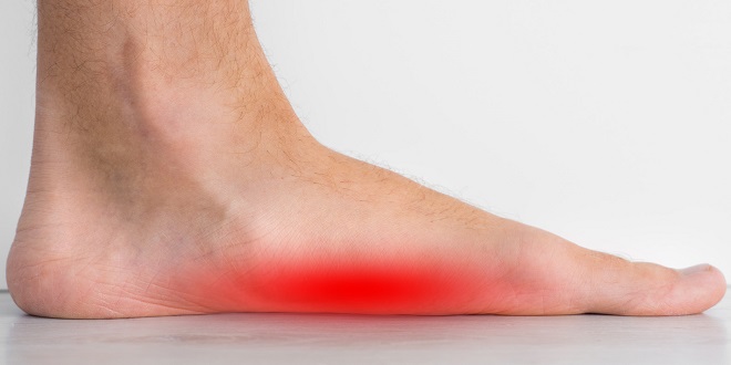Flat feet - When should I seek medical help?