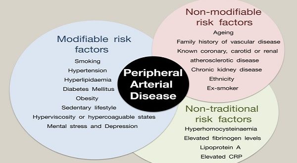 Understanding The Risk Factors For Peripheral Arterial Disease