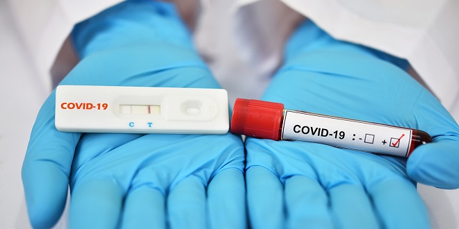 Benefits of Rapid PCR Test for COVID 19