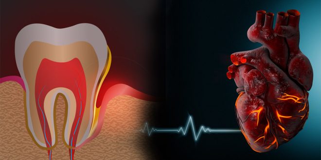 The Connection Between Oral Health and Heart Disease