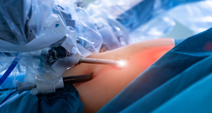 What are the plus points of robotic surgery? Get to know now!