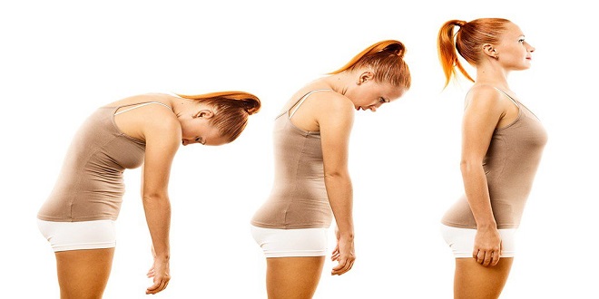 How Chiropractors Can Help Improve Posture