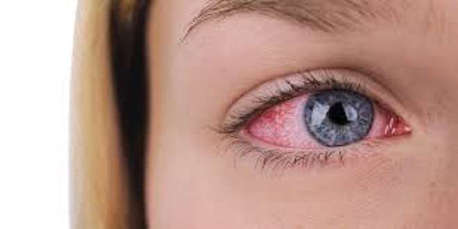 Diagnosis and Treatment: Common Eye Diseases Ophthalmologists Encounter